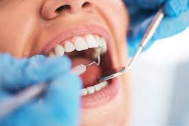 Cáncer Oral y como prevenirlo. CEM Valderas Clinica Dental Alcorcón