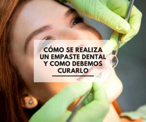 Clínica Dental Alcorcón CEM Valderas. Como se Realiza un empaste dental y como curarlo