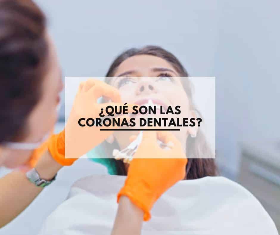 ¿Que son las coronas dentales?. Clinica Dental CEM Valderas Odontologos en Alcorcón