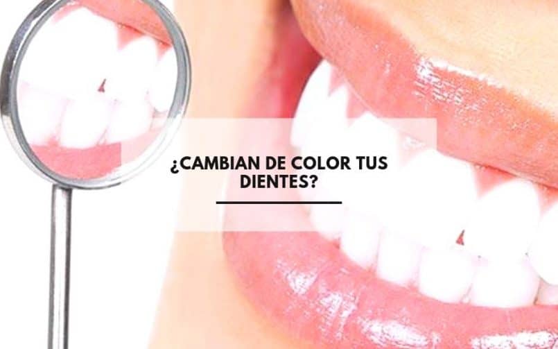 ¿Cambian de Color tus Dientes?. CEM Calderas Clínica Dental en Alcorcón