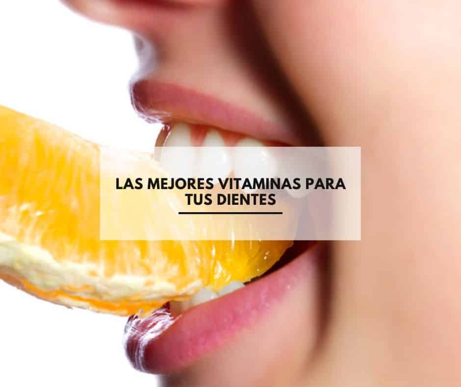 ¿Cuales son las mejores vitaminas para tus dientes?. CEM Valderas Clinicas dentales en Alcorcón