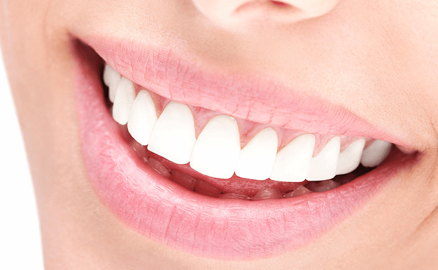 Peróxido de hidrógeno para blanquear los dientes: ¿Qué debes saber?. CEM Valderas Dentistas Alcorcón.