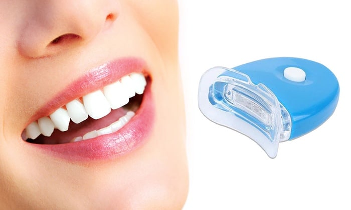 Eficacia del peróxido de hidrógeno para blanqueamiento dental. Nuestros odontólogos te lo cuentan