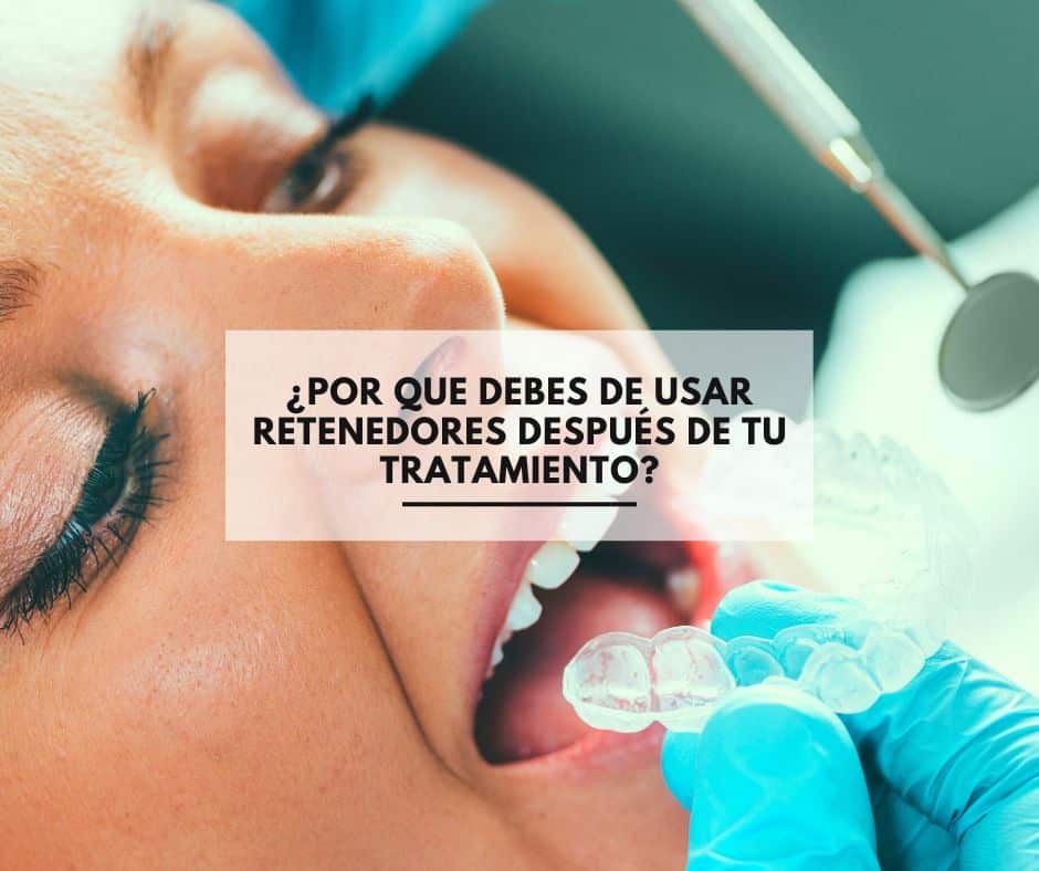 ¿Por que debes de usar retenedores después de tu tratamiento de ortodoncia?. Clinica Dental Alcorcón CEM Valderas tratamientos ortodoncia baratos