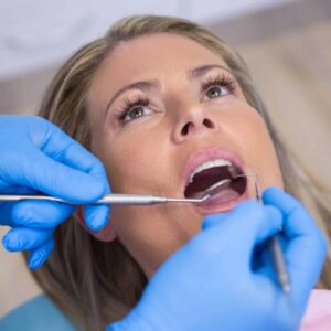 ¿Que es la pericoronitis? Tratamiento, signos y síntomas