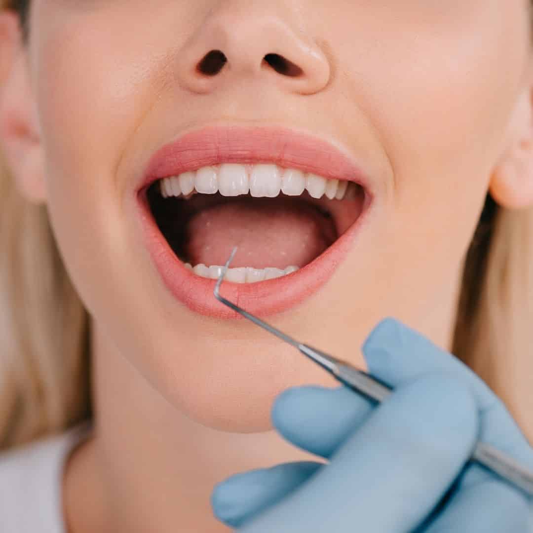 ¿Qué son las encías retraídas?