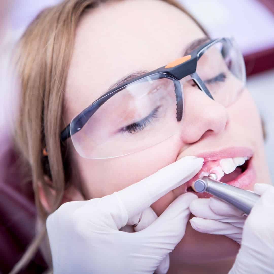 estética dental Alcorcón Cem Valderas Clínica Dental