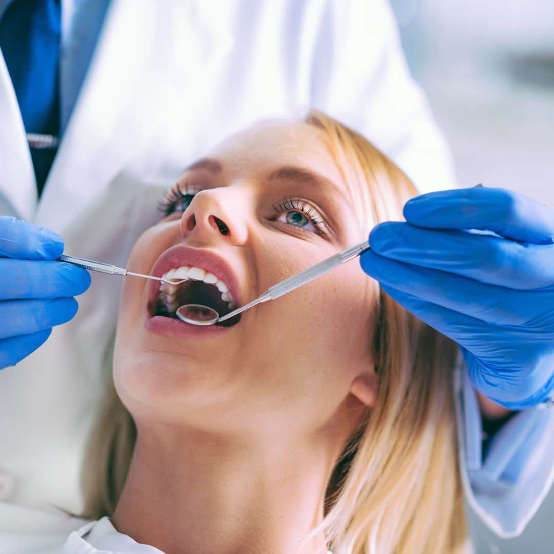 Limpieza dental: lo que debes saber