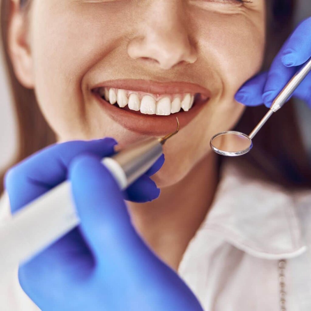 Limpieza dental: lo que debes saber
