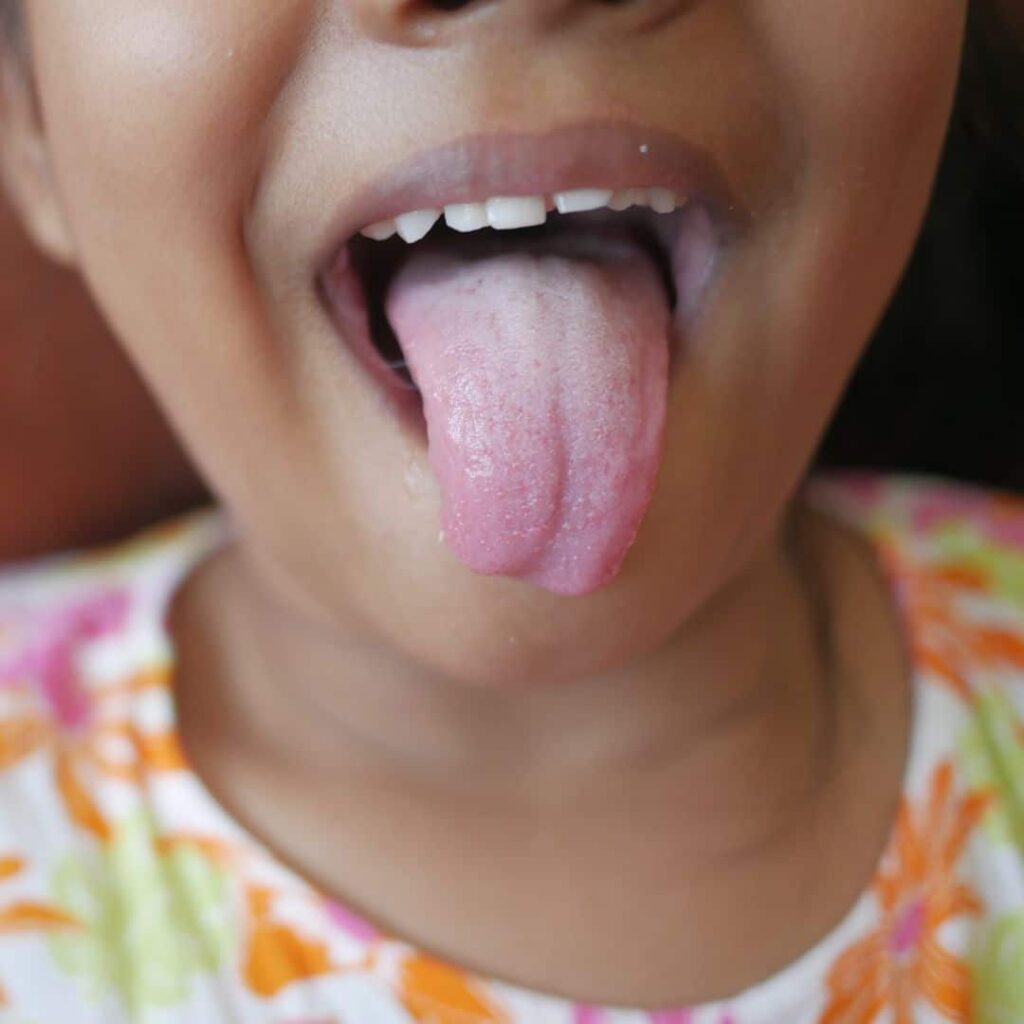 Tu lengua y tu salud bucal