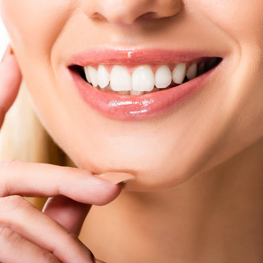 beneficios de las carillas dentales