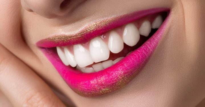 Sonrisa perfecta mediante micro-carillas de Porcelana: Láminas de porcelana de alta resistencia que se adhieren a la superficie del diente. Permiten cambiar el color, forma o posición del diente de una manera natural mejorando la estética. Actualmente las micro-carillas proporcionan una gran naturalidad. En ocasiones, cuando el diente que se quiere cubrir está muy deteriorado, hay que envolverlo en su totalidad. Es lo que se conoce como corona o funda. las fundas son de zirconio, ya que así permiten obtener una estética idéntica a las de las carillas cuando se hace necesario alternar unas y otras.