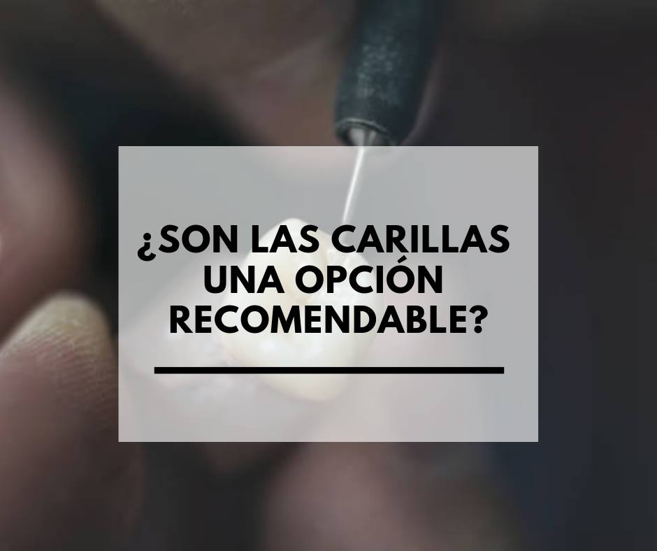 Dentistas Alcorcón. Odontólogos CEM Valderas. Carillas