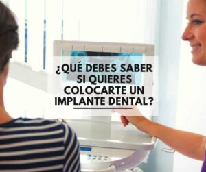 implantes dentales ¿Qué debes saber si quieres colocarte un implante dental?