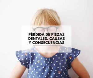 Consecuencia de la perdida de piezas dentales. Clínica Dental CEM Valderas Dentistas en Alcorcón