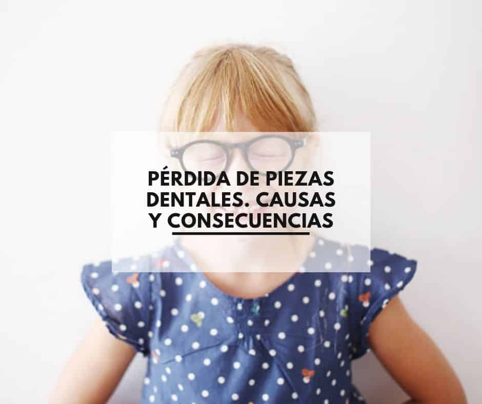 Consecuencia de la perdida de piezas dentales. Clínica Dental CEM Valderas Dentistas en Alcorcón