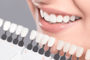 Peróxido de hidrógeno para blanquear los dientes: ¿Qué debes saber?. Nuestros dentistas en Alcorcón te lo cuentan. CEM Valderas Clínica Dental en Alcorcón, Mostoles, Leganés, Fuenlabrada, Getafe, Parla