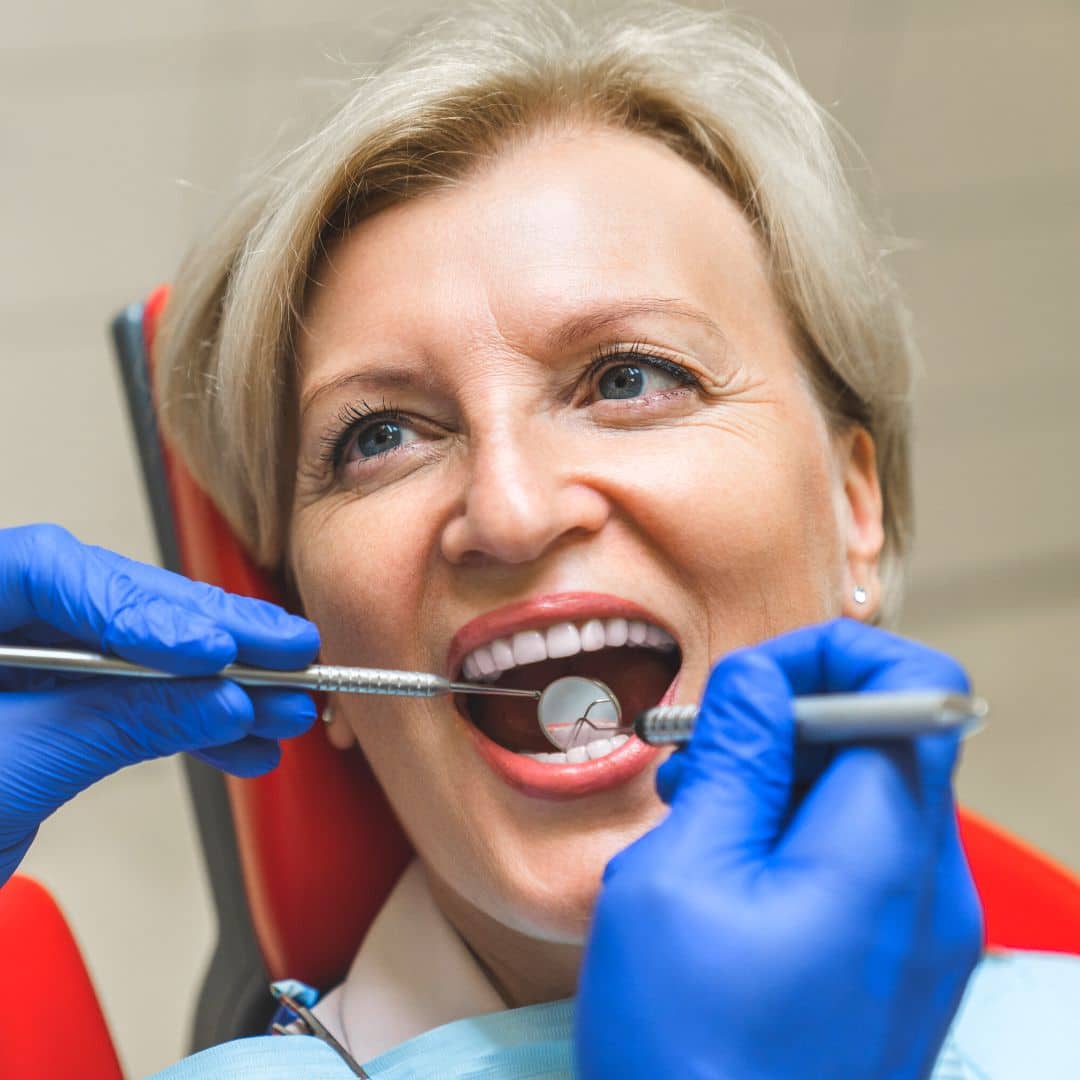 implantes dentales